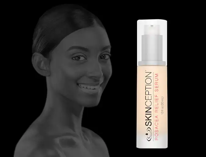 skinception-rosacea-treatment review